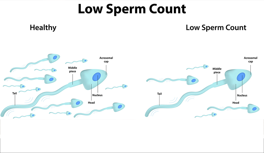 Normal male sperm counts