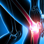 knee pain medical bills